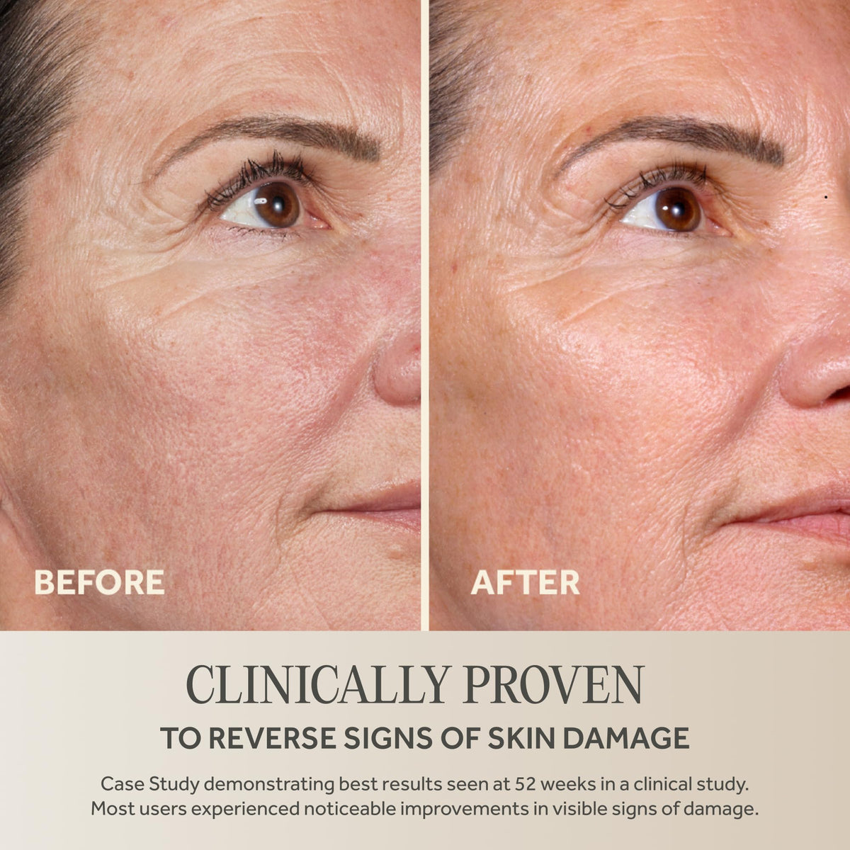 No7 Future Renew Serum application on skin