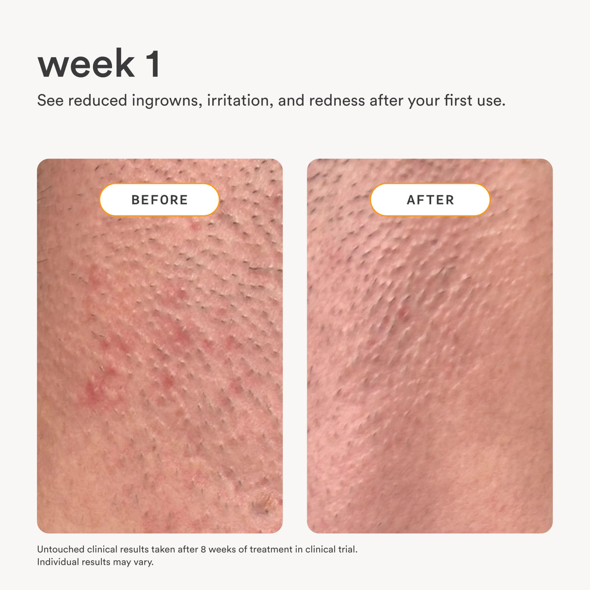 Nood Serum 3.3oz with shaving accessories
