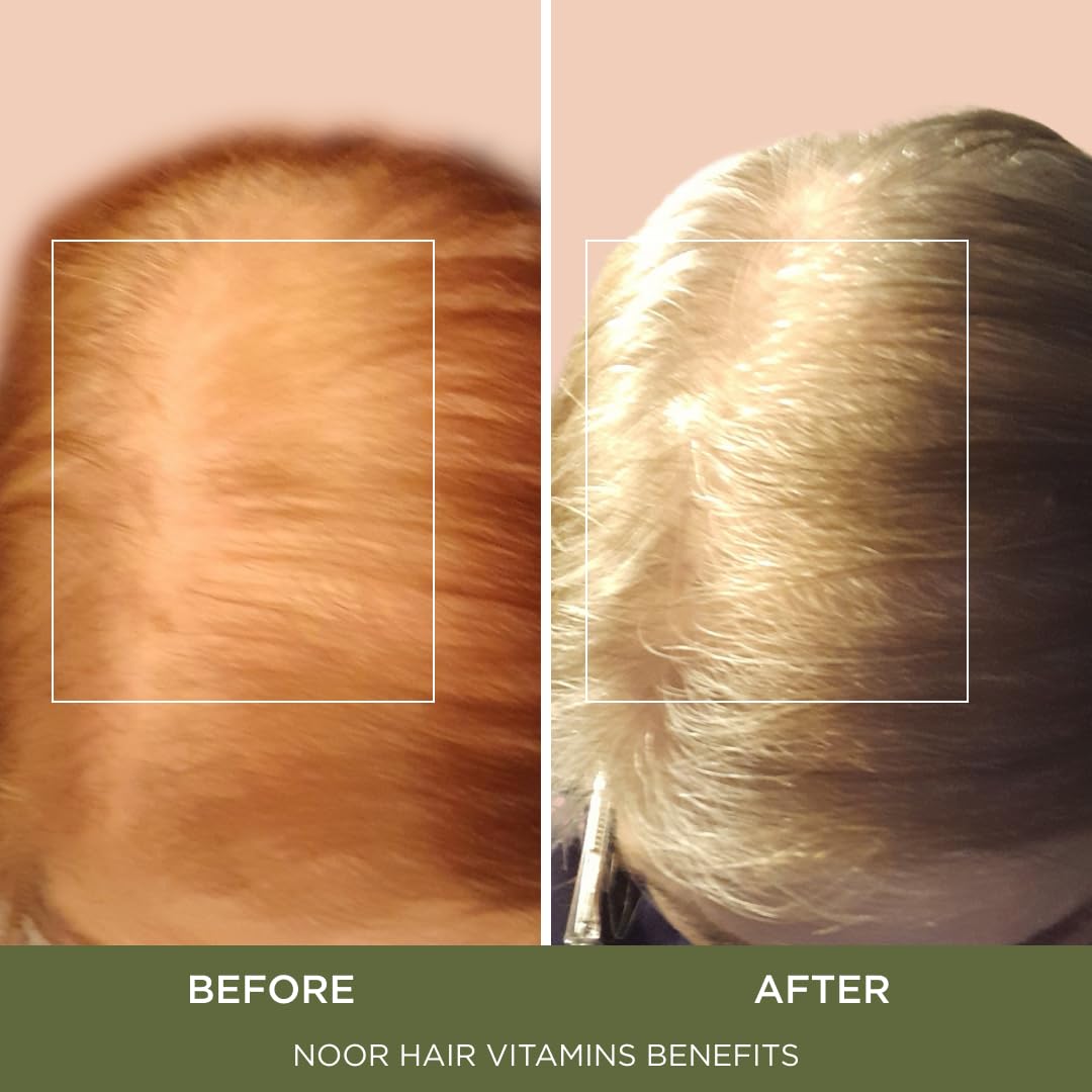 NOOR HAIR Healthy Hair Formula bottle side view