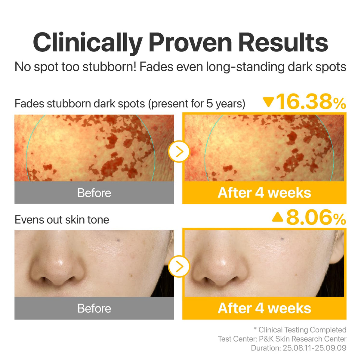 numbuzin No.5 Glutathione TXA Dark Spot Ampoule lifestyle scene