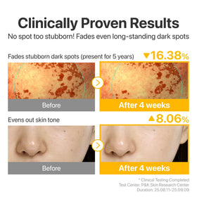 numbuzin No.5 Glutathione TXA Dark Spot Ampoule lifestyle scene