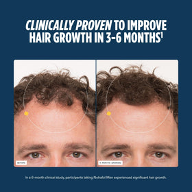 Nutrafol Men Hair Growth Supplements capsules on a wooden surface