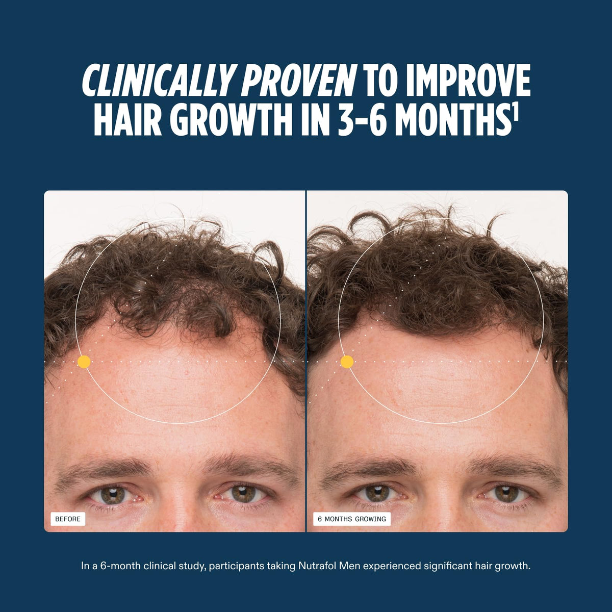 Nutrafol Men Hair Growth Supplements ingredients list