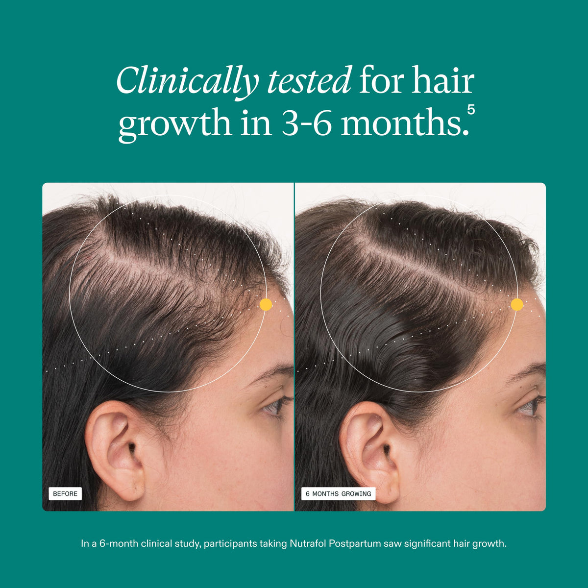 Nutrafol Postpartum Hair Growth Supplements capsules close-up