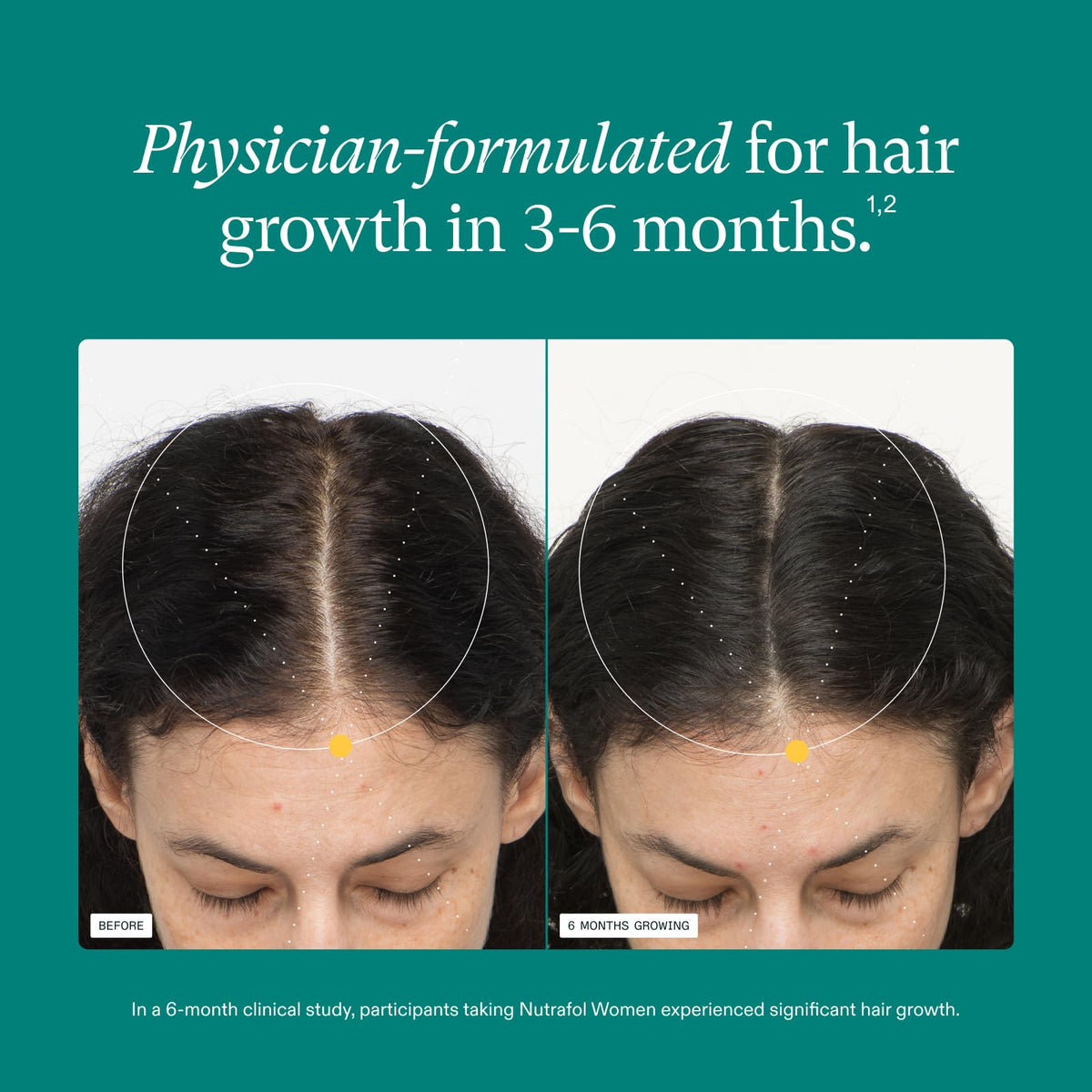 Nutrafol Women Hair Growth Supplements packaging side view