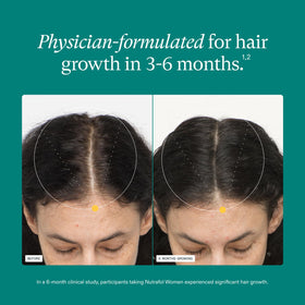 Nutrafol Women Hair Growth Supplements packaging side view