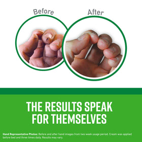 O'Keeffe's Working Hands Hand Cream jar side view
