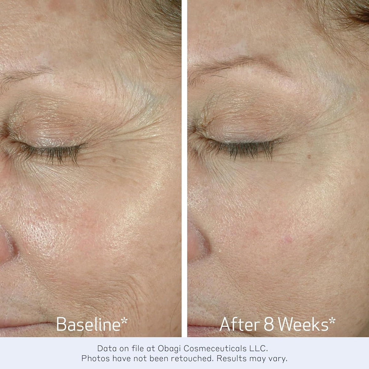 Obagi Medical ELASTIderm Eye Cream application on skin