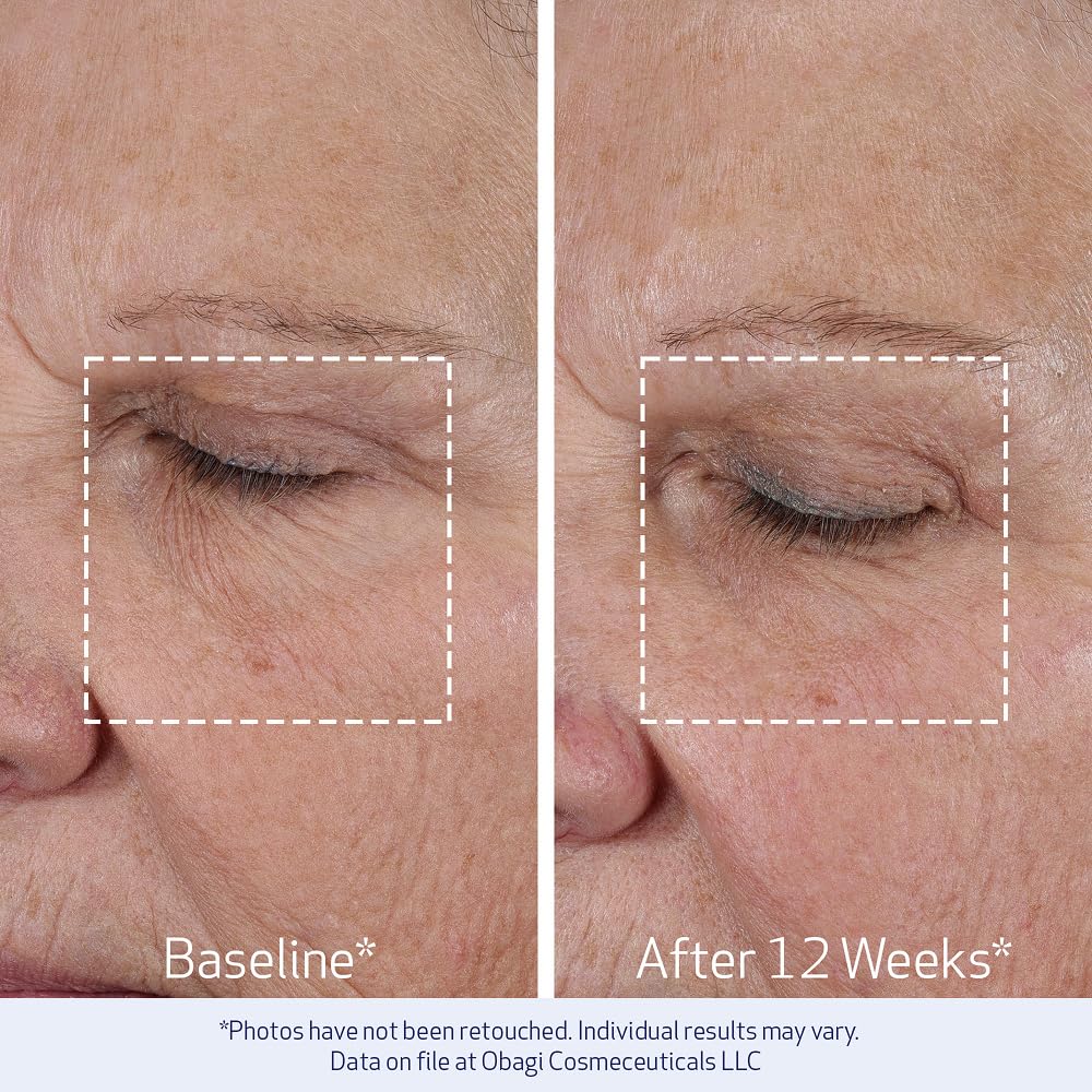 Obagi Medical ELASTIderm Lift Up & Sculpt Facial Moisturiser application on skin