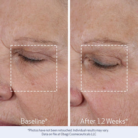 Obagi Medical ELASTIderm Lift Up & Sculpt Facial Moisturiser application on skin