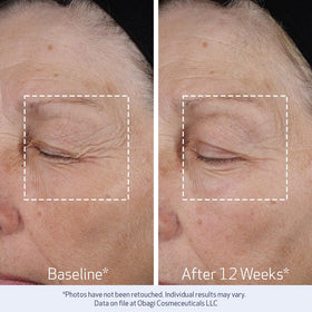 Obagi Medical ELASTIderm Lift Up & Sculpt Facial Moisturiser texture close-up