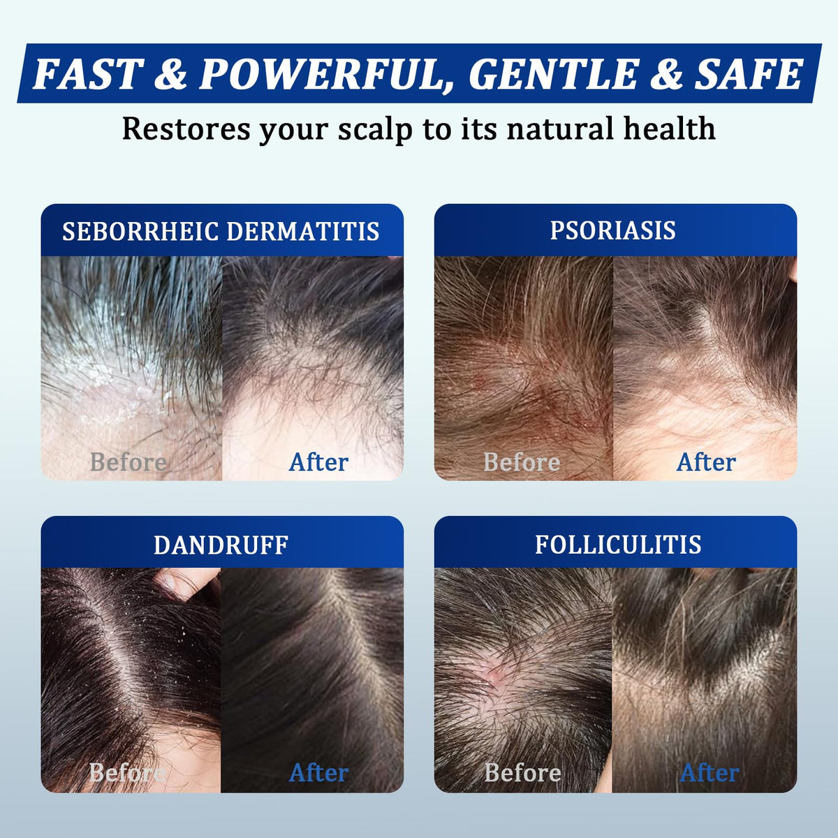 oely Anti-Dandruff Shampoo and Conditioner set lifestyle scene