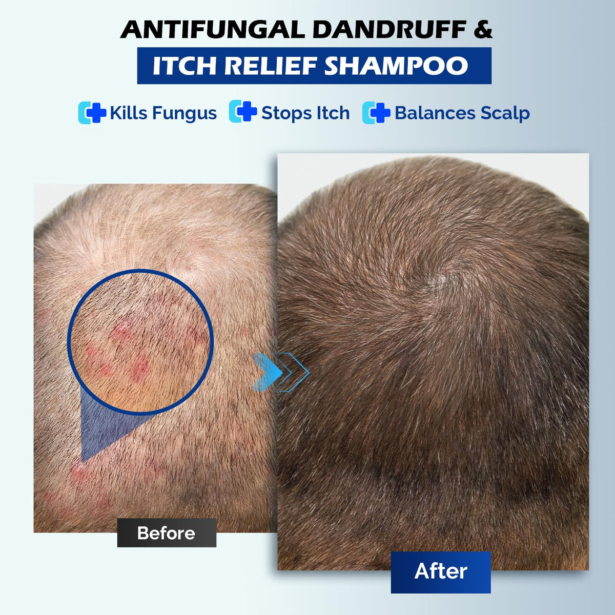 oely Antifungal Shampoo 345g back view