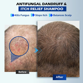 oely Antifungal Shampoo 345g back view