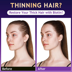 oely Hair Growth Biotin Shampoo 340g back view