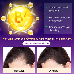 oely Hair Growth Biotin Shampoo 340g side view