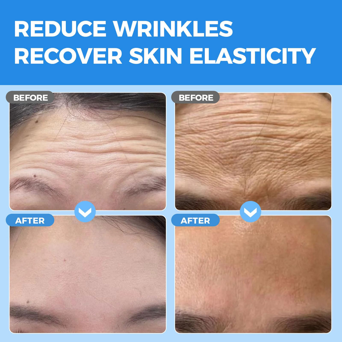 Okela Forehead Wrinkle Patches jelly-like texture close-up