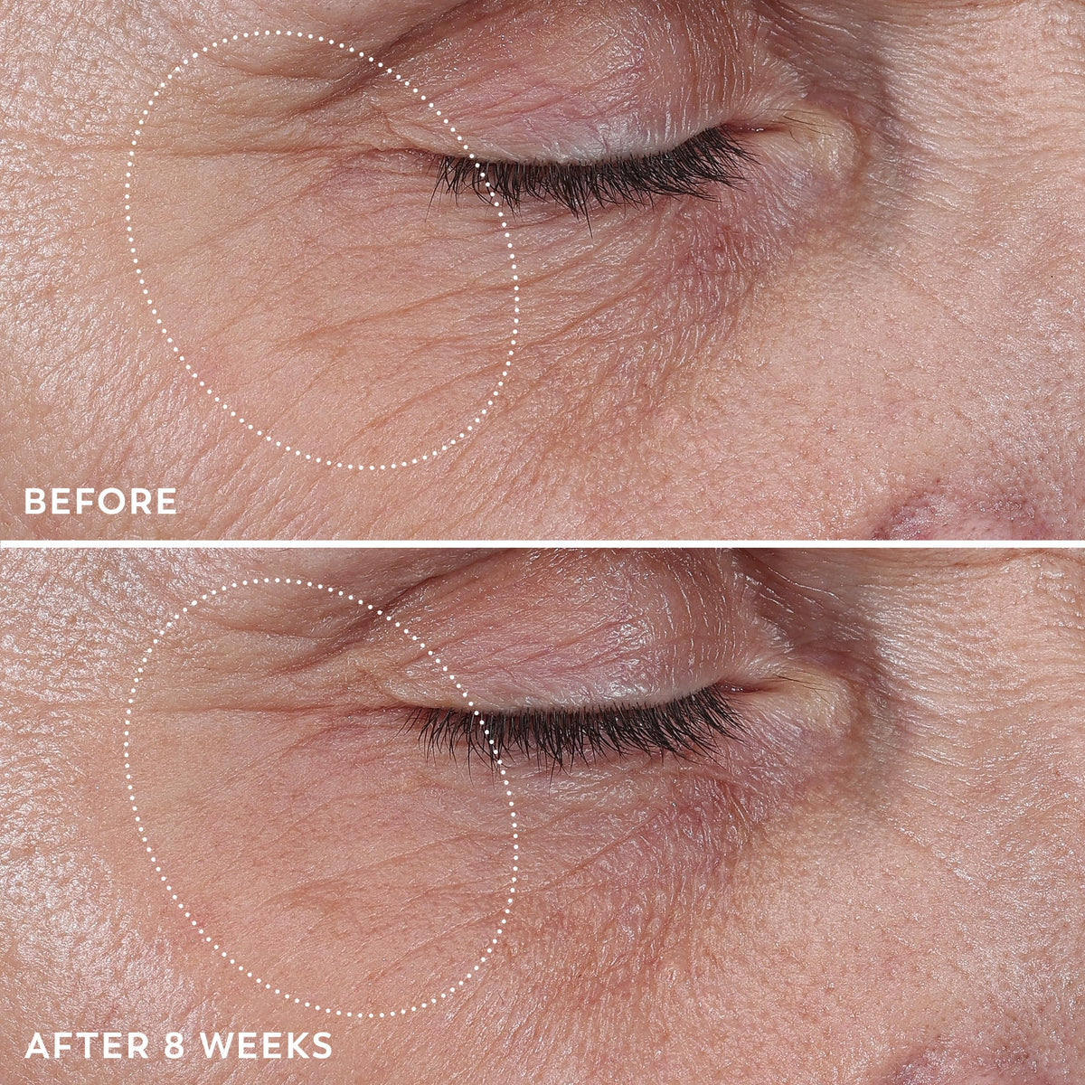 Olay Eye Cream Roller with cap removed