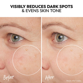 Olay Pro-X serum packaging with product details
