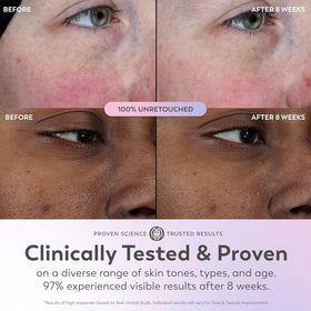 Olay Super Serum 5-in-1 Glow Serum lifestyle shot