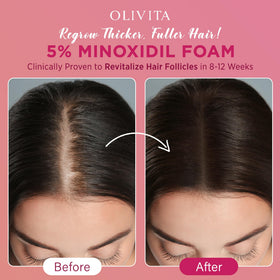 OLIVITA 5% Minoxidil Foam packaging and instructions