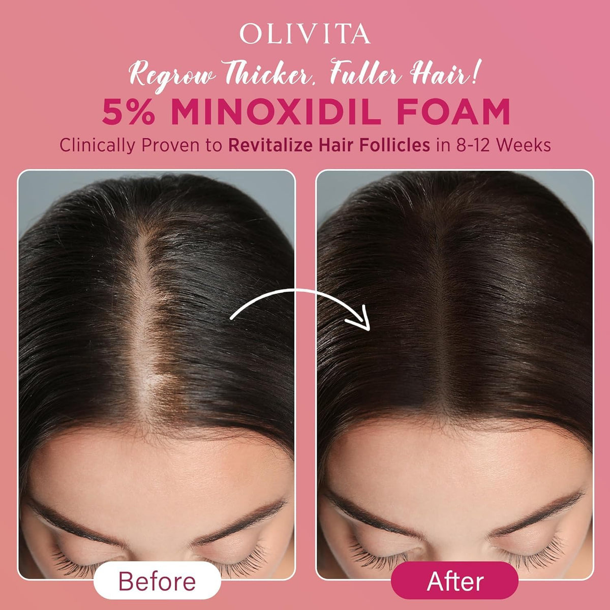OLIVITA 5% Minoxidil Foam side view showing texture