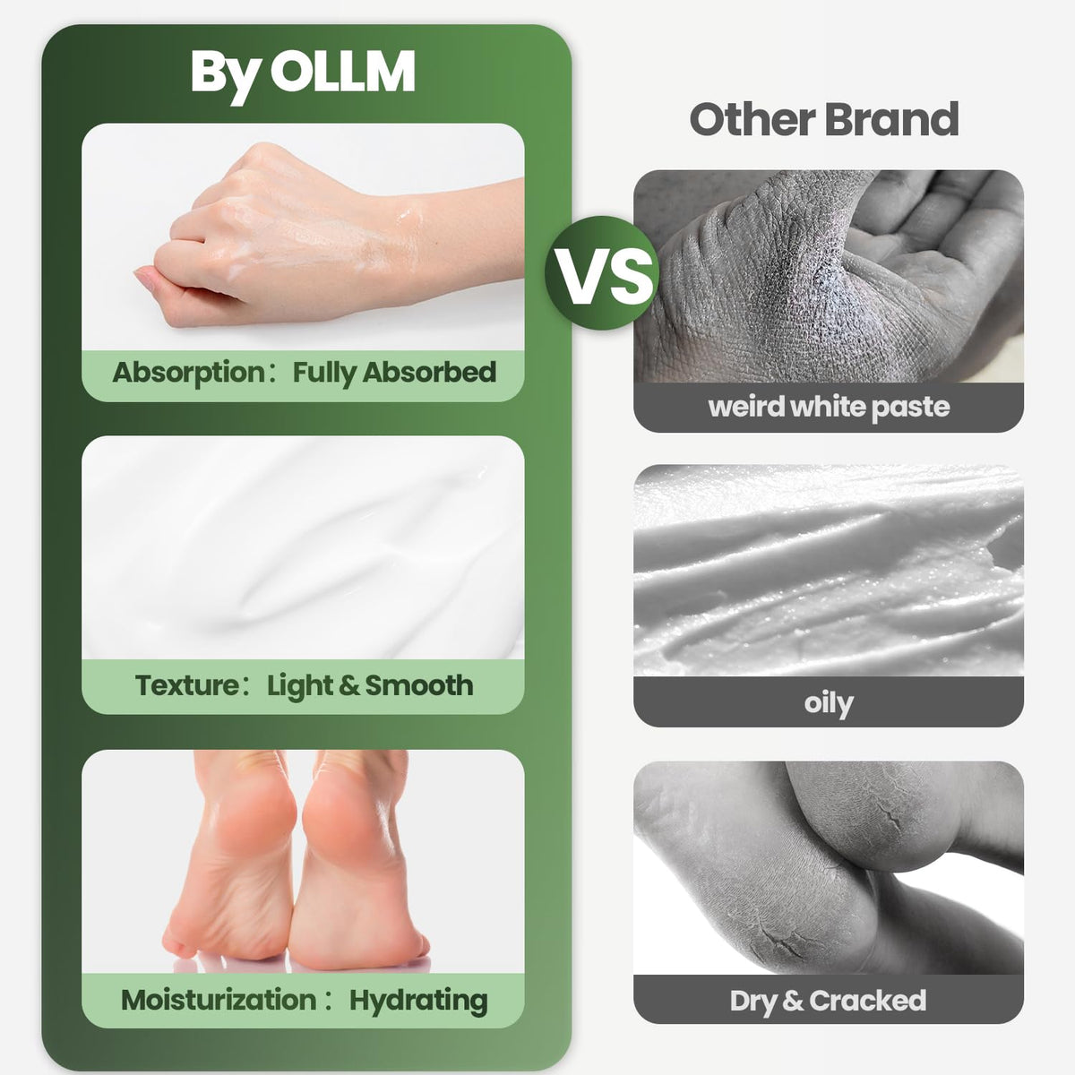 OLLN Urea Cream 40% back view with label