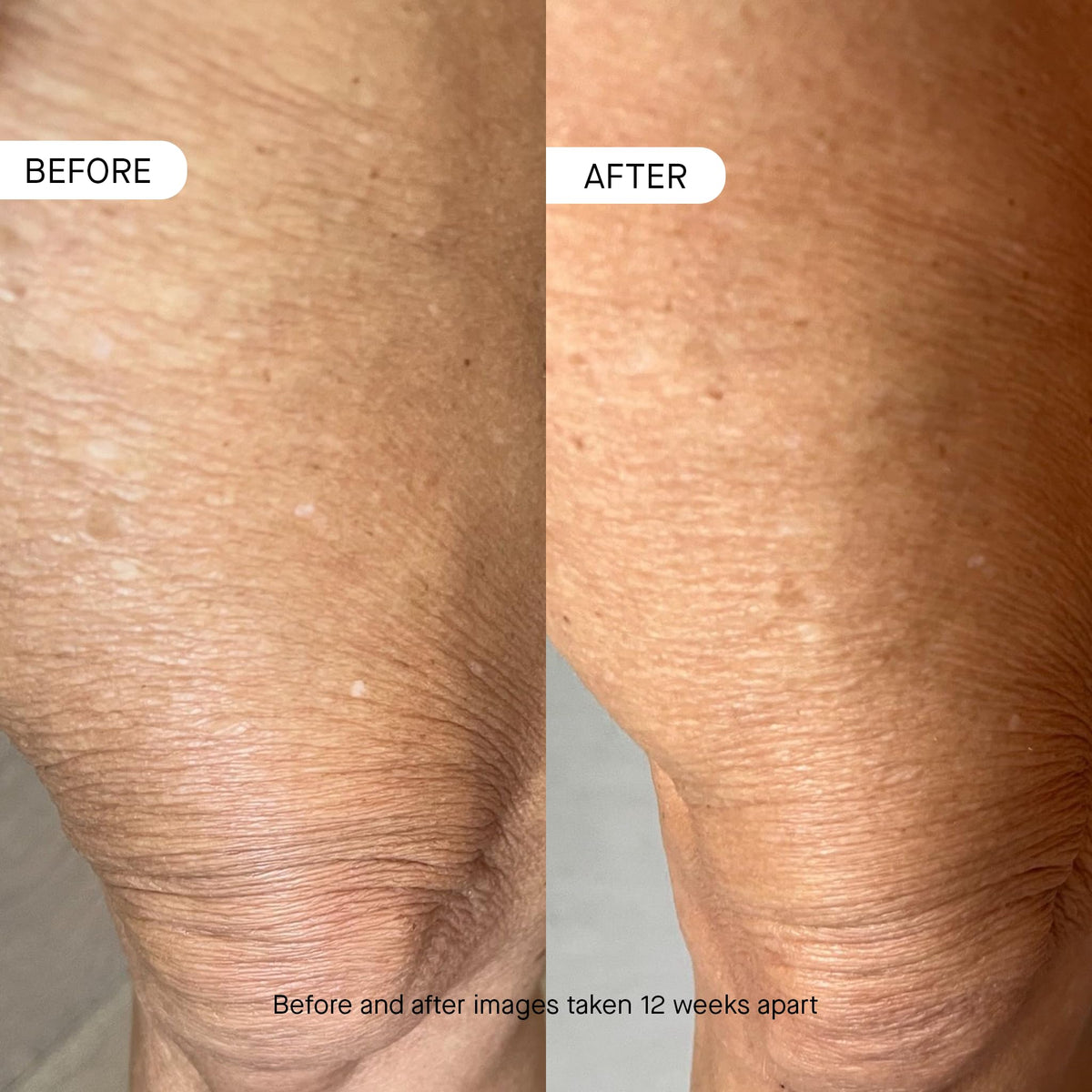 oneskin OS-01 BODY Topical Supplement Moisturizer with packaging