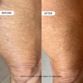 oneskin OS-01 BODY Topical Supplement Moisturizer with packaging