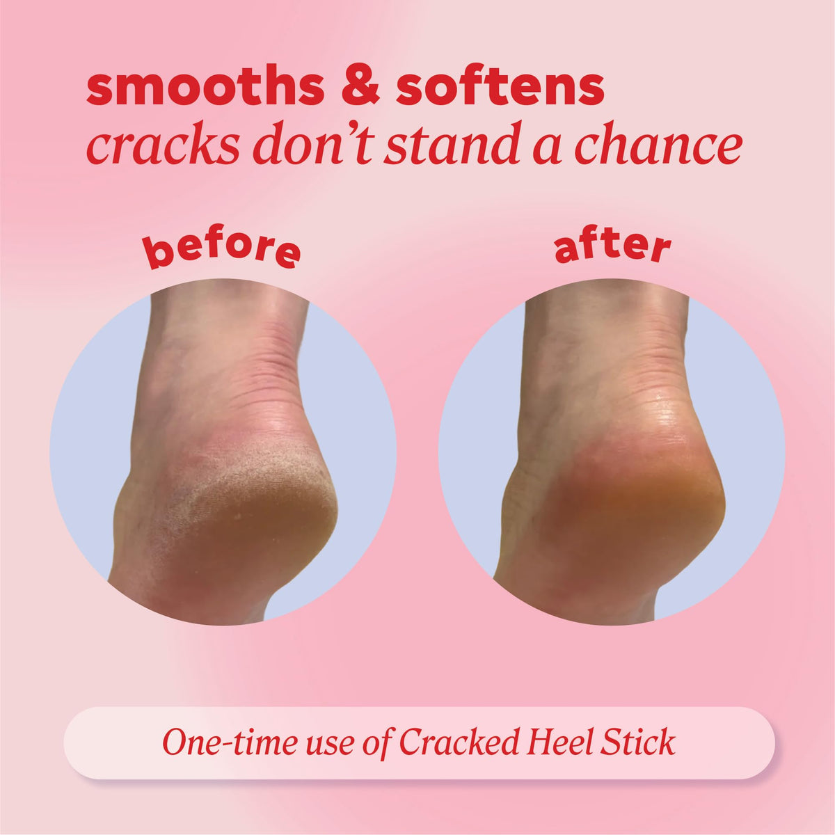 Onyx Professional Cracked Heel Repair Balm Stick on a wooden surface