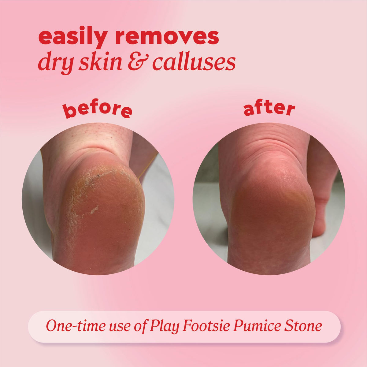 Onyx Professional Double Sided Pumice Stone smooth side close-up