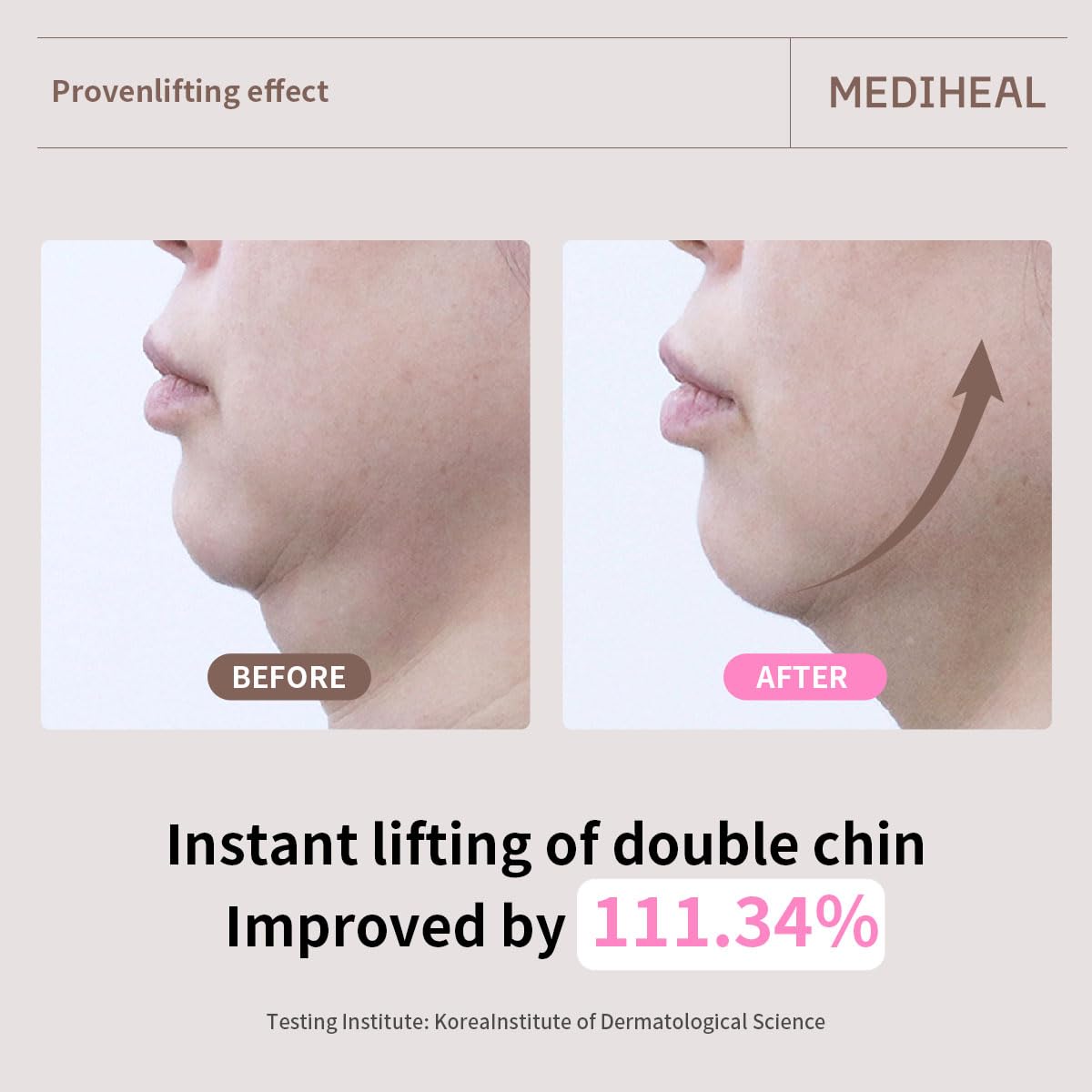 Open MEDIHEAL Retinol Collagen Lifting Mask showing individual masks