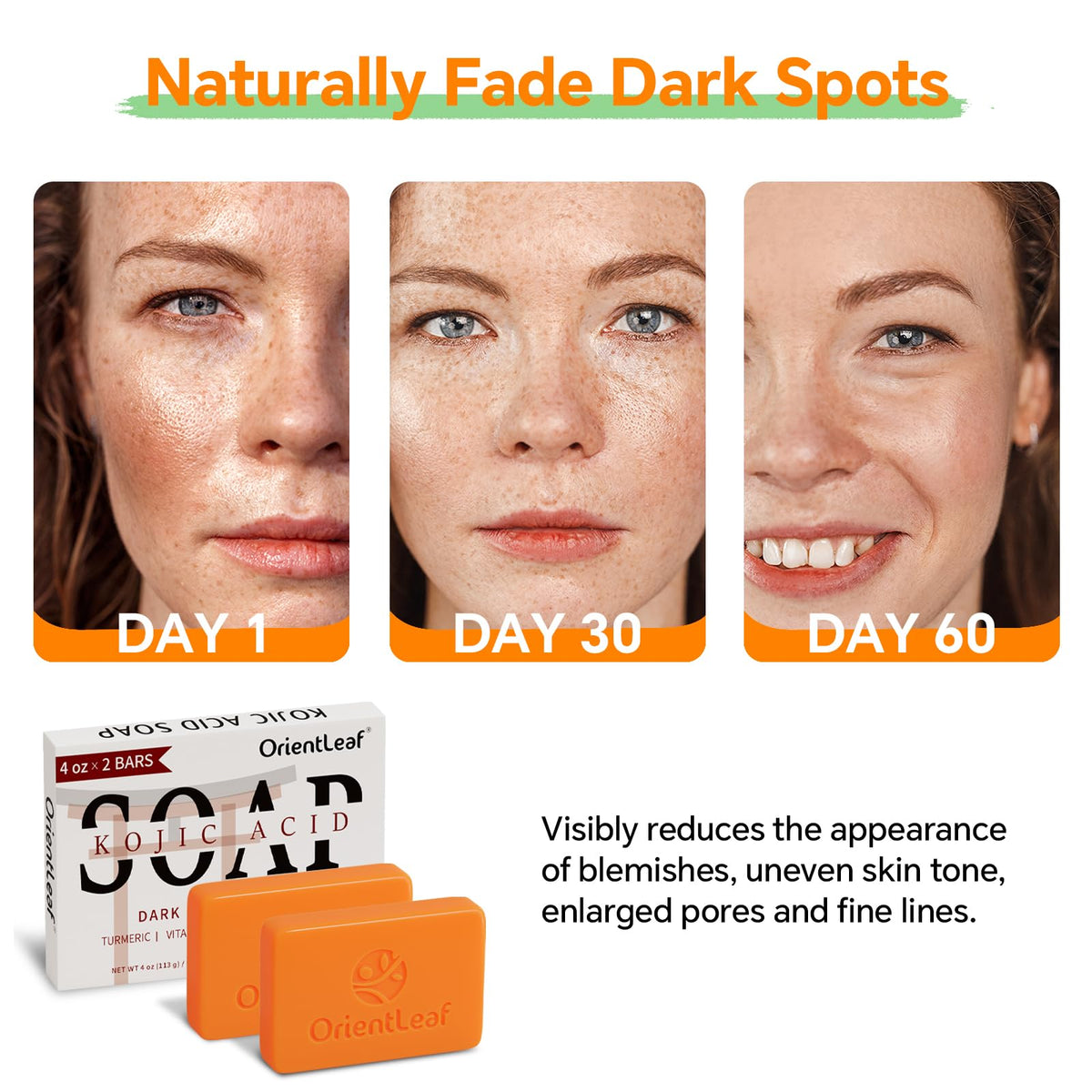 ORIENTLEAF Kojic Acid and Turmeric Soap Bar packaging