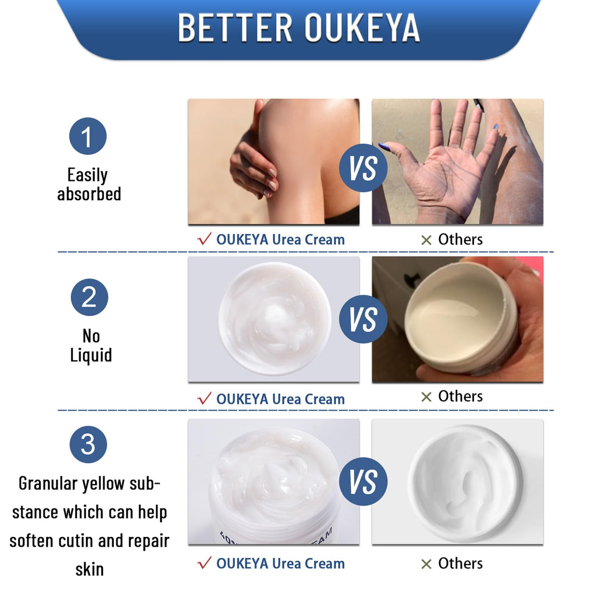 OUKEYA 40% Urea Cream application on dry skin