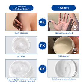 OUKEYA 42% Urea Cream on a bathroom shelf