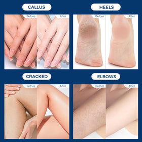 OUKEYA foot care products arranged