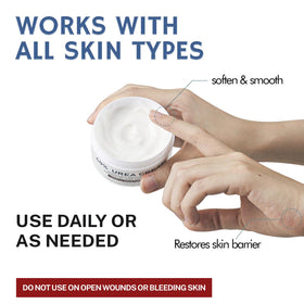 OUKEYA Urea Cream 40 Percent application on hands