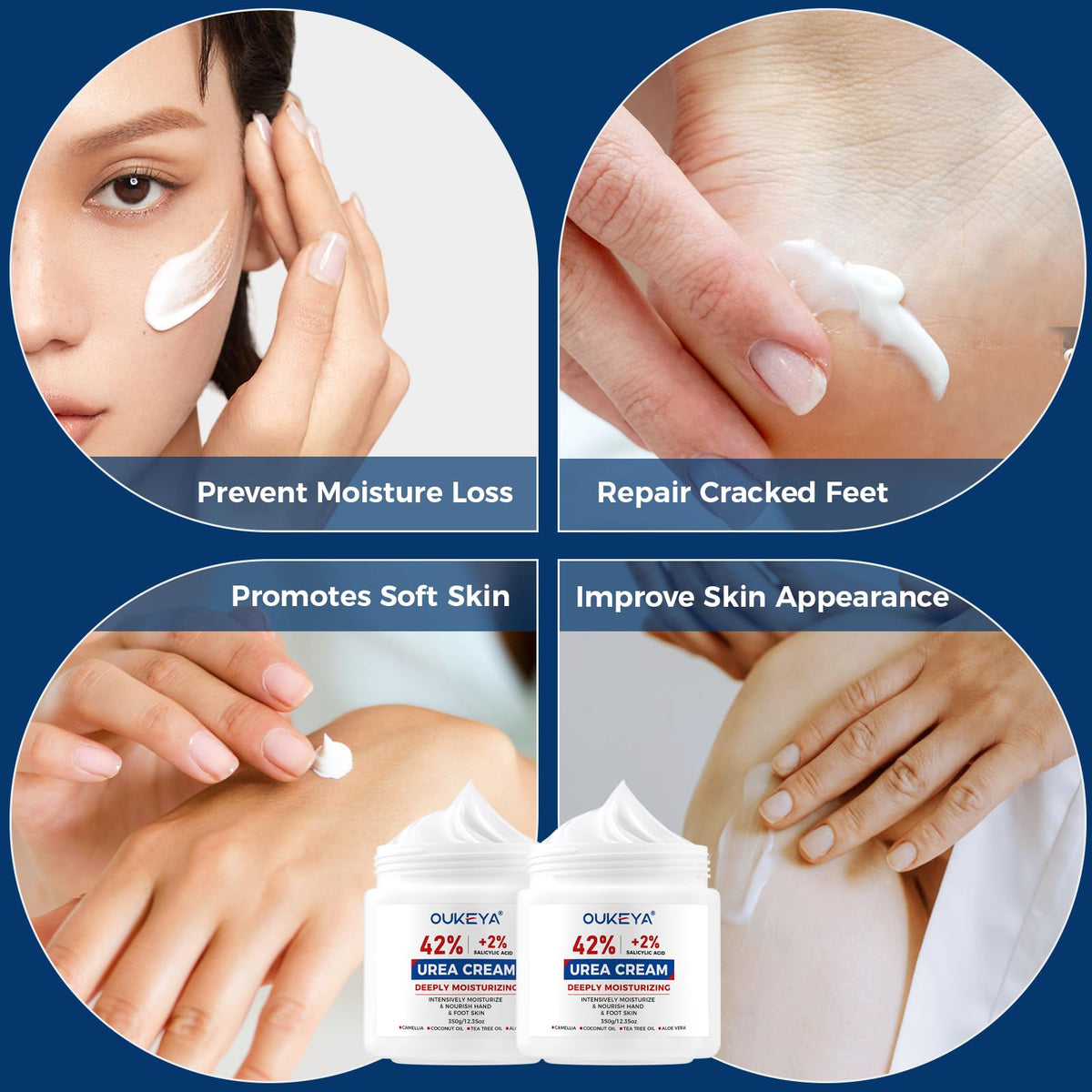 OUKEYA Urea Cream application on hands