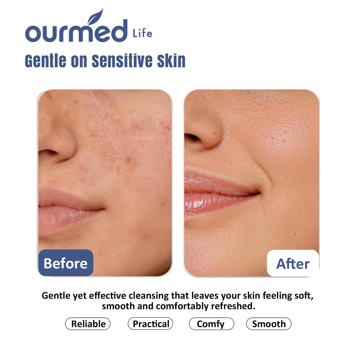 ourmed life disposable face towels showing dual-texture design