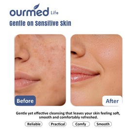 ourmed life disposable face towels showing dual-texture design