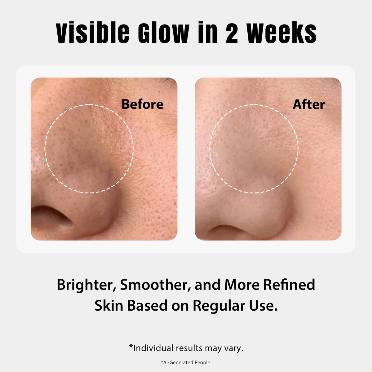 ourmed life toner pads in use on a model's face