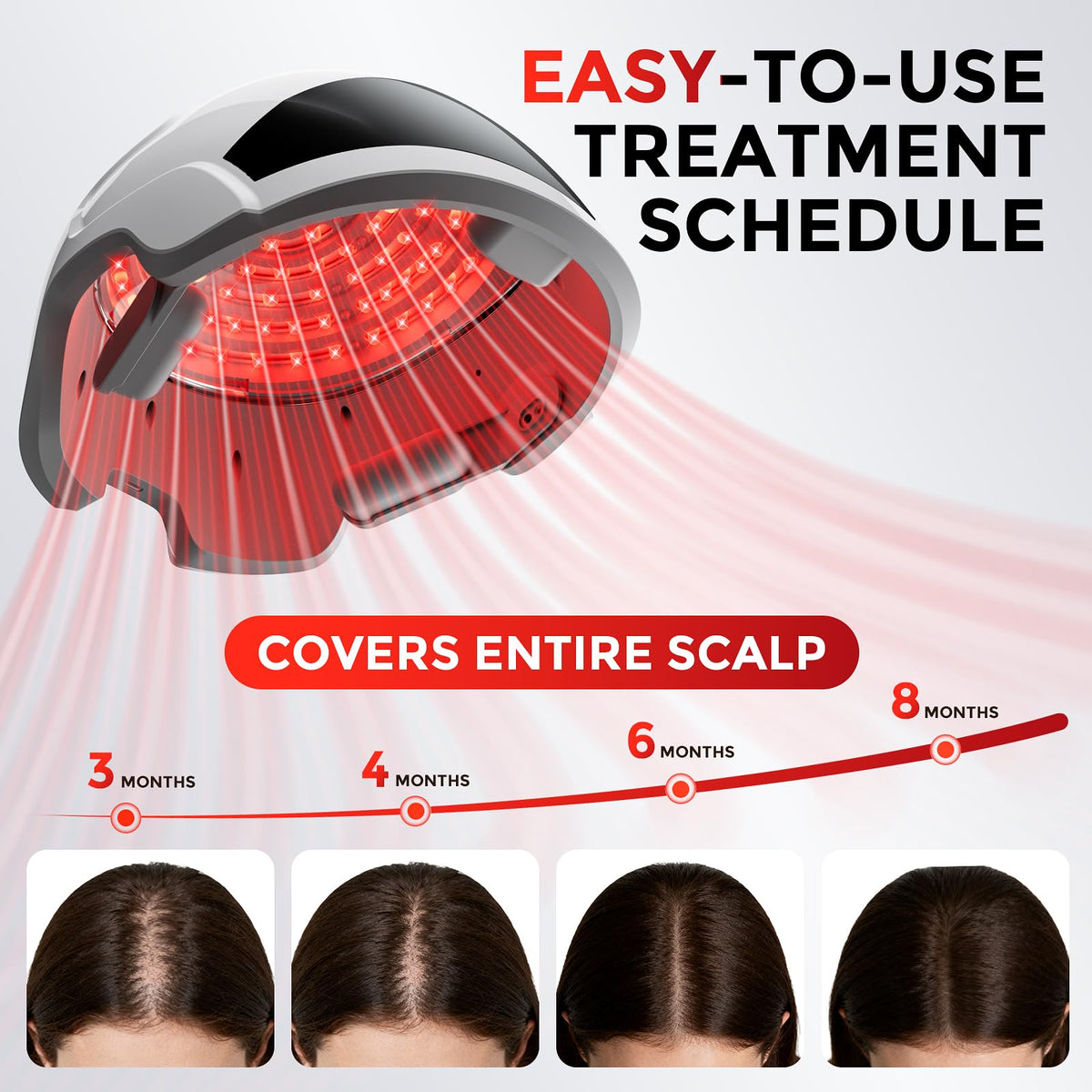 OVEKPA Hair Growth Laser Cap side view showcasing laser light technology