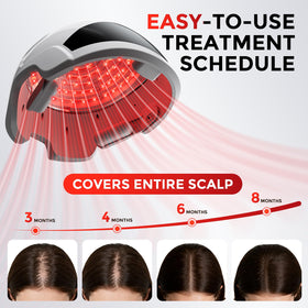 OVEKPA Hair Growth Laser Cap side view showcasing laser light technology