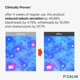 P.CALM Underpore Foam Cleanser 150ml texture close-up
