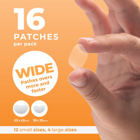 PatchRx Chin Pimple Patches applied on skin