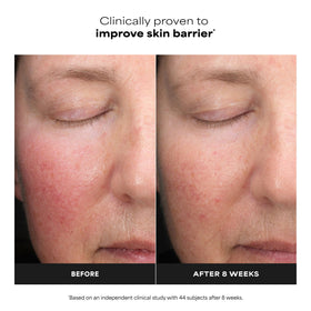 Paula's Choice 6% Mandelic + 2% Lactic Acid Liquid Exfoliant packaging