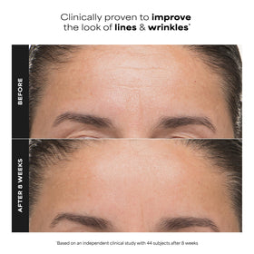 Paula's Choice 6% Mandelic + 2% Lactic Acid Liquid Exfoliant side view