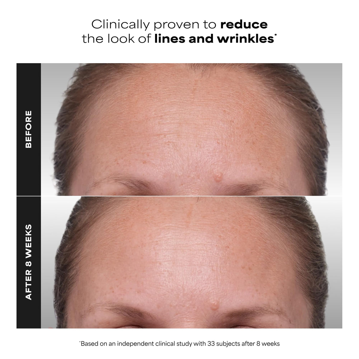 Paula's Choice CLINICAL 1% Retinol Cream with packaging