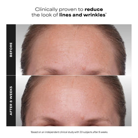 Paula's Choice CLINICAL 1% Retinol Cream with packaging
