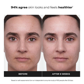Paula's Choice CLINICAL 1% Retinol Face lifestyle scene